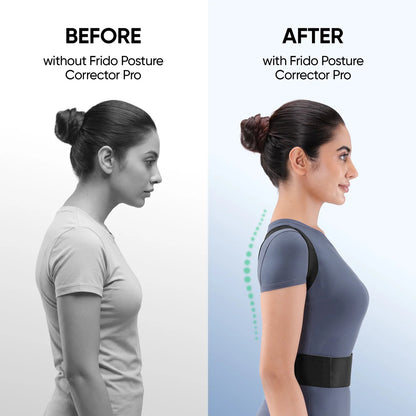 Posture Corrector